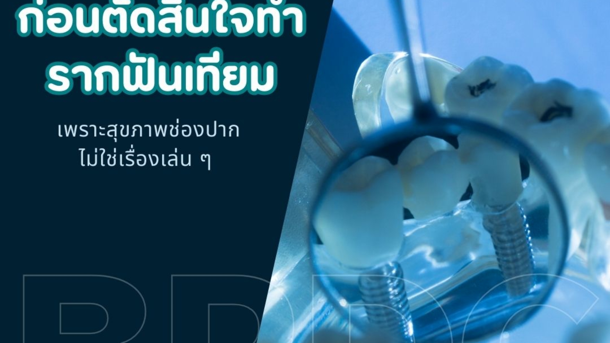 เช็คลิสต์! ก่อนตัดสินใจทำรากฟันเทียม