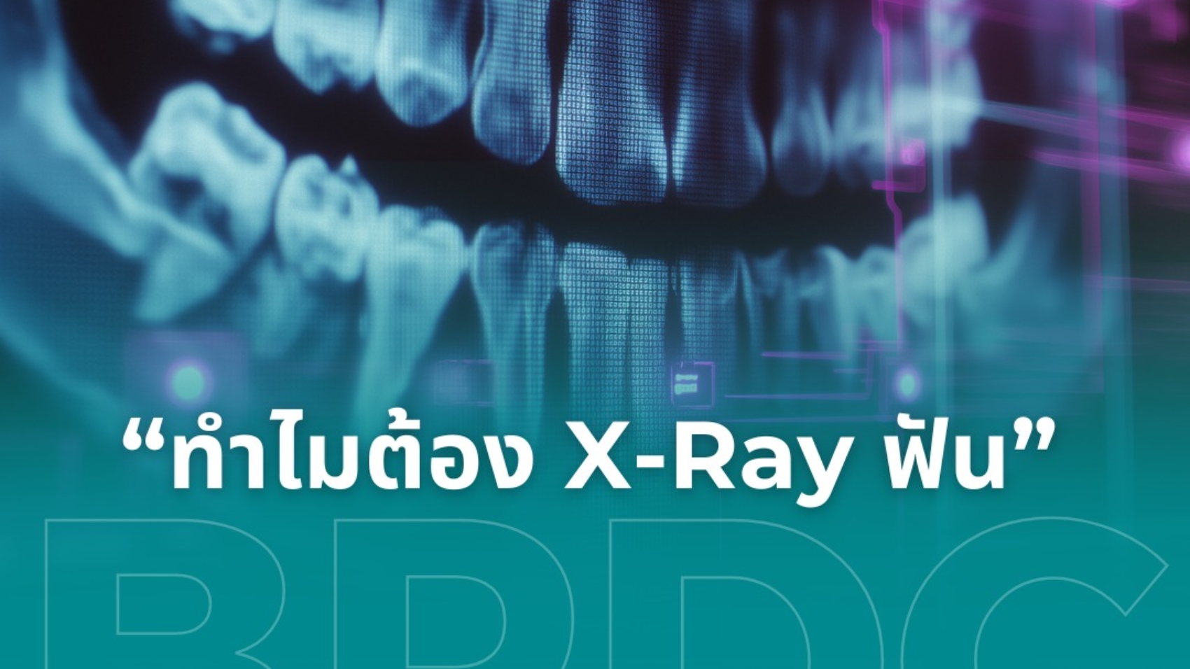 ทำไมต้อง X-Ray ฟัน