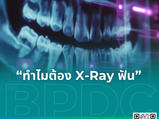 ทำไมต้อง X-Ray ฟัน