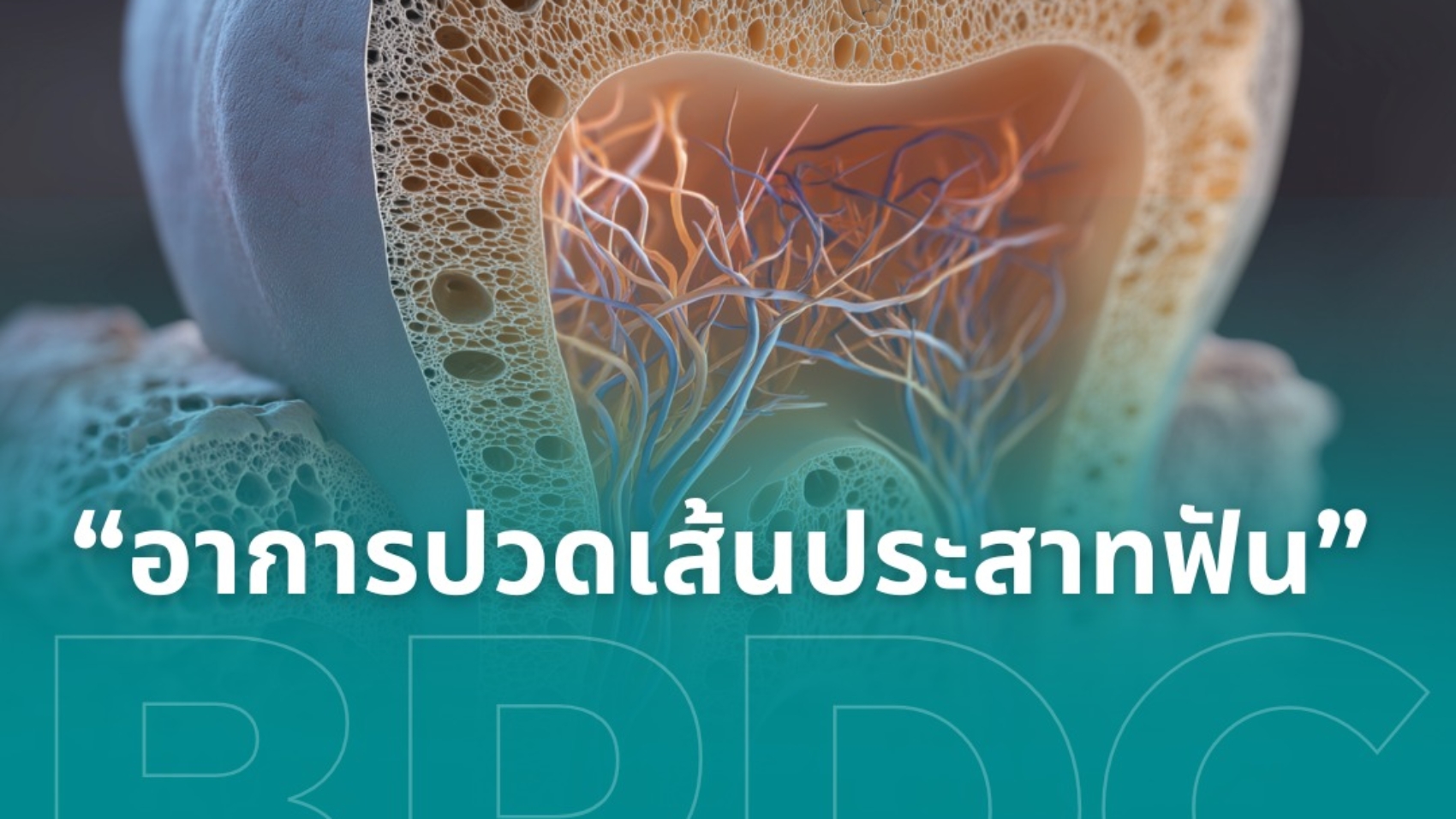 อาการปวดเส้นประสาทฟัน