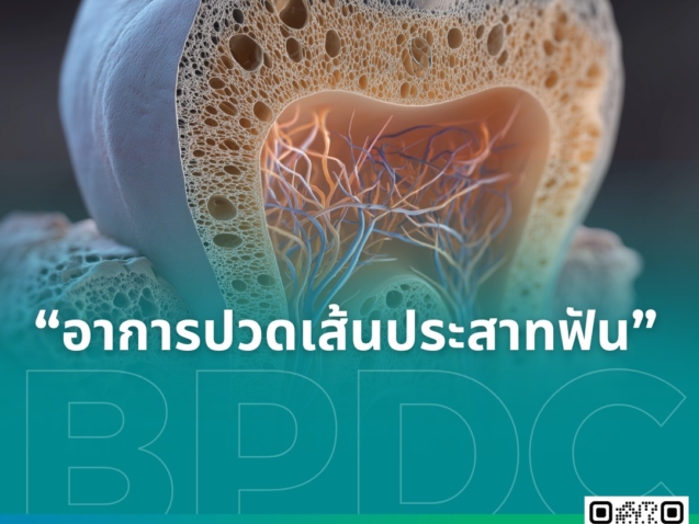 อาการปวดเส้นประสาทฟัน