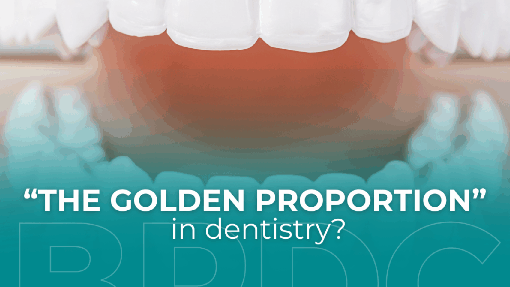 The Golden Proportion in Dentistry