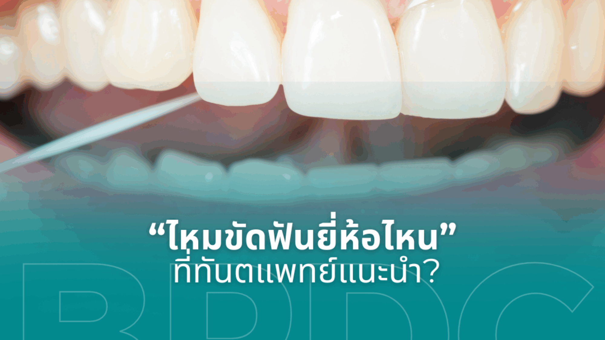 ไหมขัดฟันยี่ห้อไหนที่ทันตแพทย์แนะนำ 2026