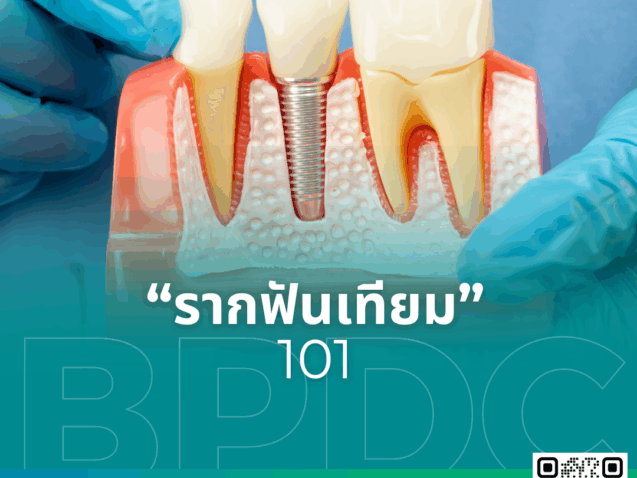 รากฟันเทียม 101
