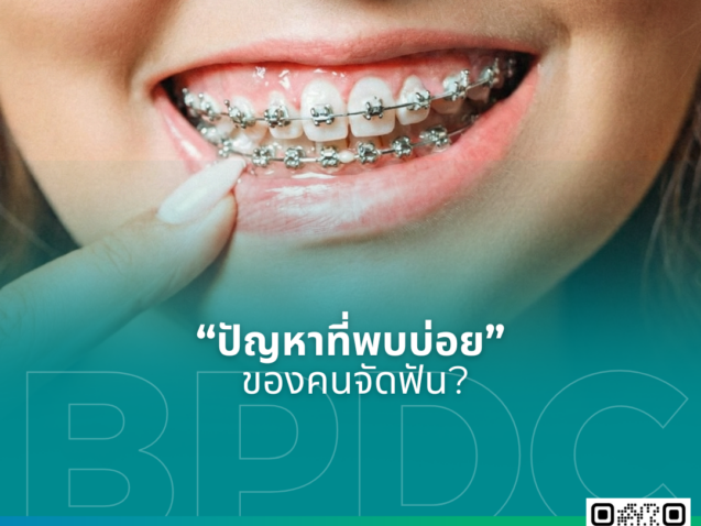 ปัญหาที่พบบ่อยของคนจัดฟัน