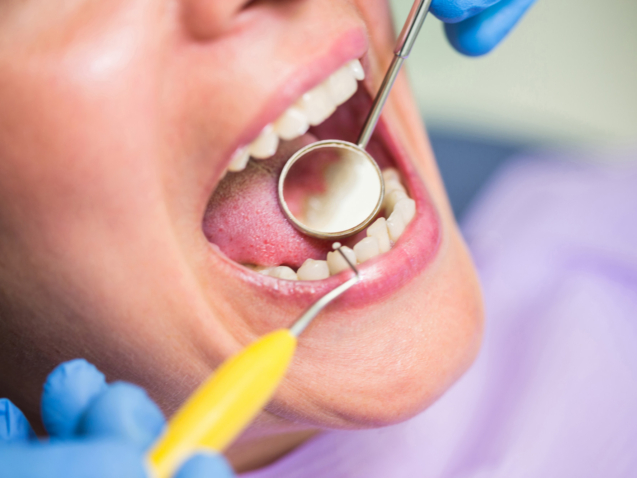 ขูดหินปูนประกันสังคม ไม่ต้องสำรองจ่ายทำอย่างไร