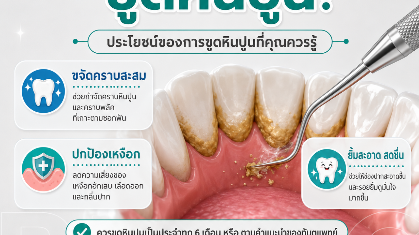 ก็แปรงฟันทุกวันอยู่แล้ว ทำไมยังต้องขูดหินปูนอีก