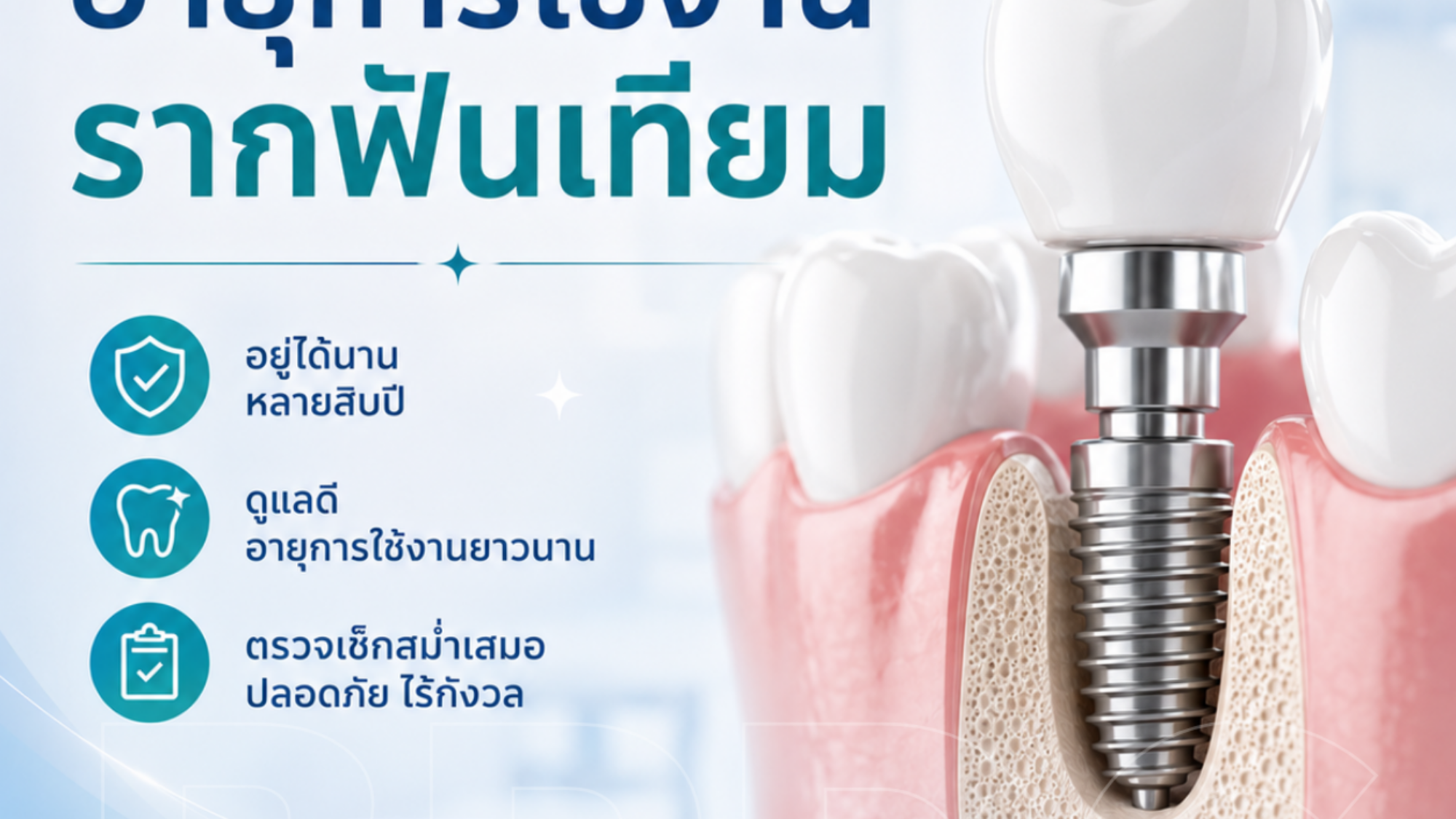 อายุการใช้งานรากฟันเทียม