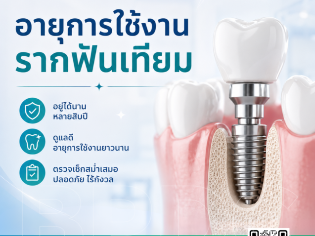 อายุการใช้งานรากฟันเทียม