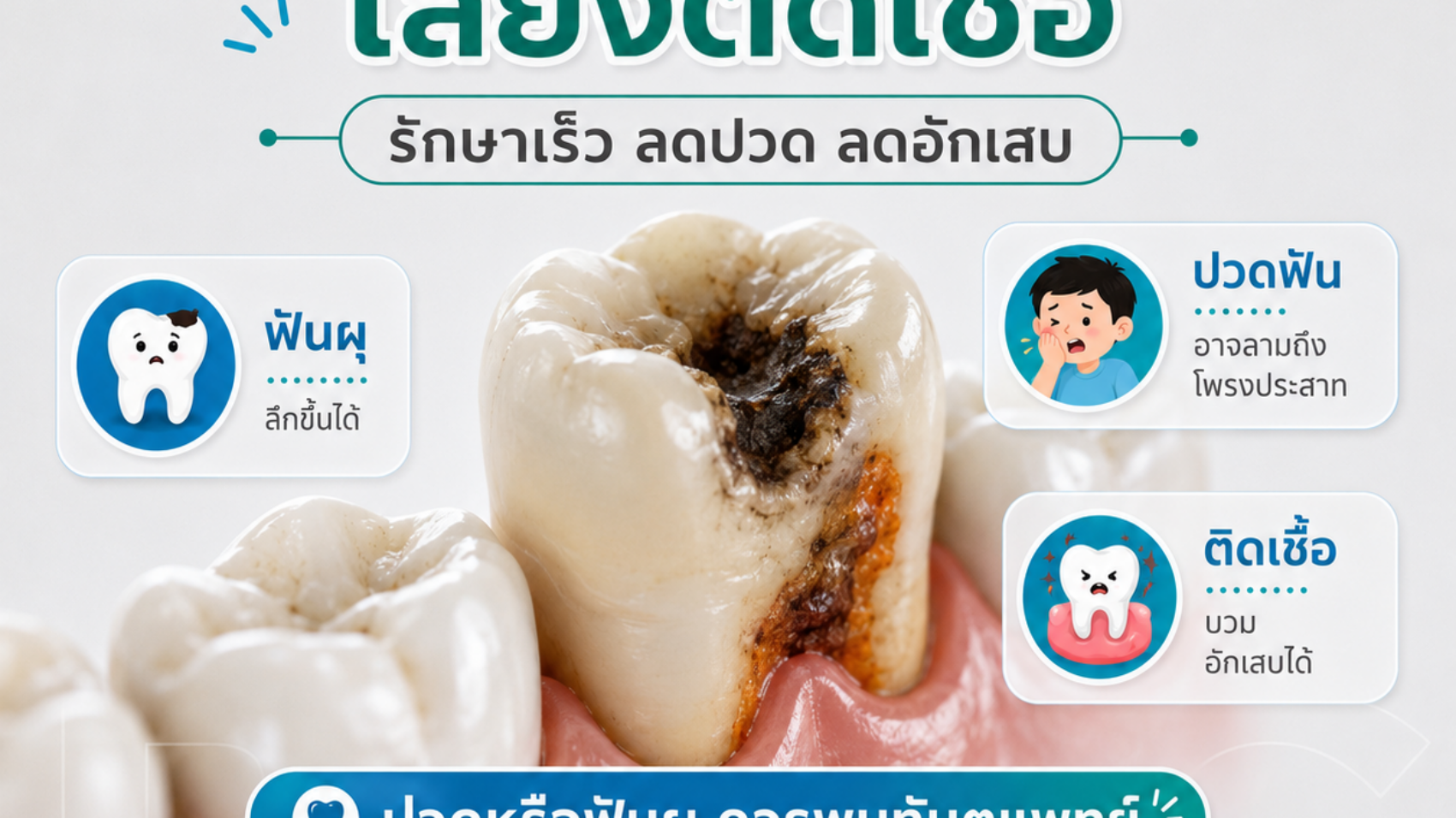 ฟันผุปล่อยไว้เสี่ยงติดเชื้อ