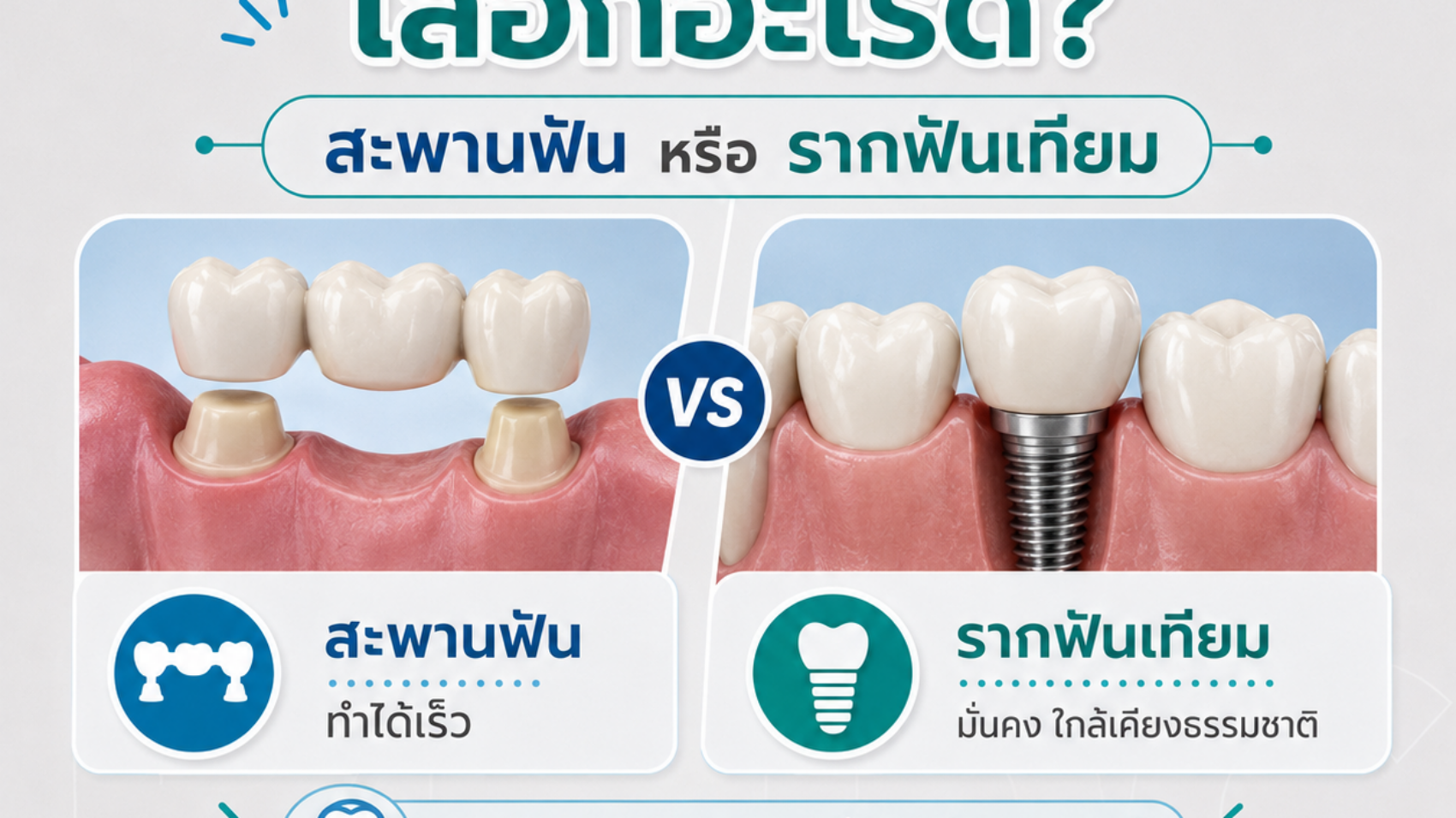 สะพานฟันกับรากฟันเทียม