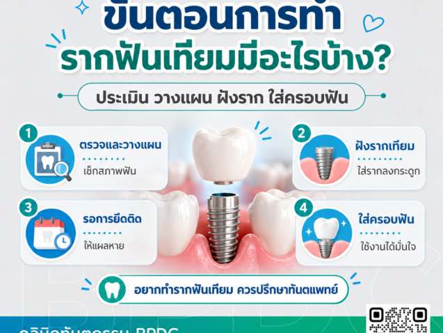 ขั้นตอนการทำรากฟันเทียม