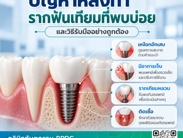 ปัญหาหลังทำรากฟันเทียมที่พบบ่อย