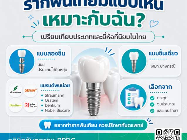 รากฟันเทียมแบบไหนเหมาะกับฉัน